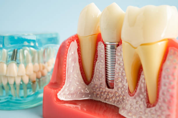 Our Range of Dental Services in Lacy Lakeview, TX